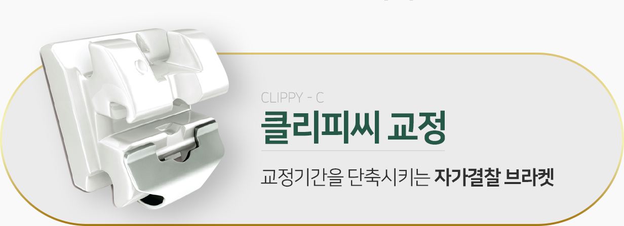 클리피씨-교정-교정기간을-단축시키는-자가결찰-브라켓