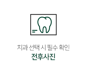 전후사진